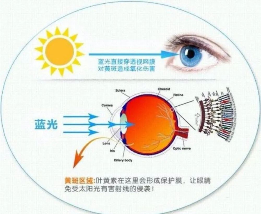 都说叶黄素可以预防近视，它到底是“眼黄金”还是“智商税”？